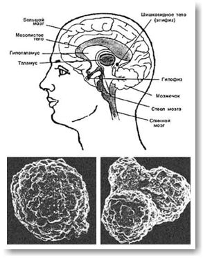 Большой фтористый заговор