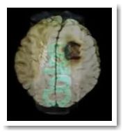 Большой фтористый заговор