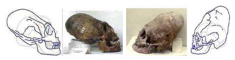 Черепа, превышающие по объему обычный человеческий почти в два раза (на прорисовках это видно).